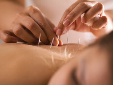 Applied Kinesiology and Acupuncture To Restore Balance In Your Body